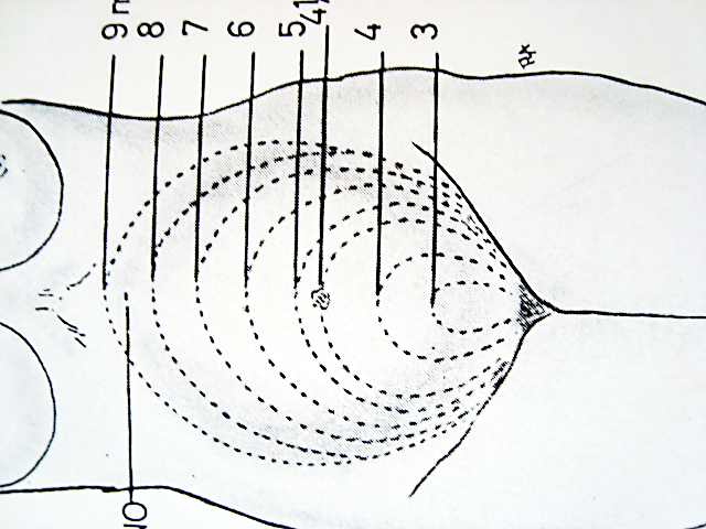 Partos Obstetricos 2